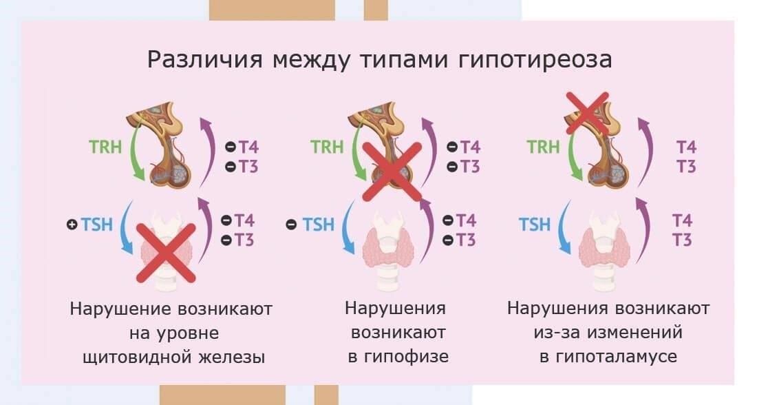 После постановки диагноза: Управление гипотиреозом во время службы